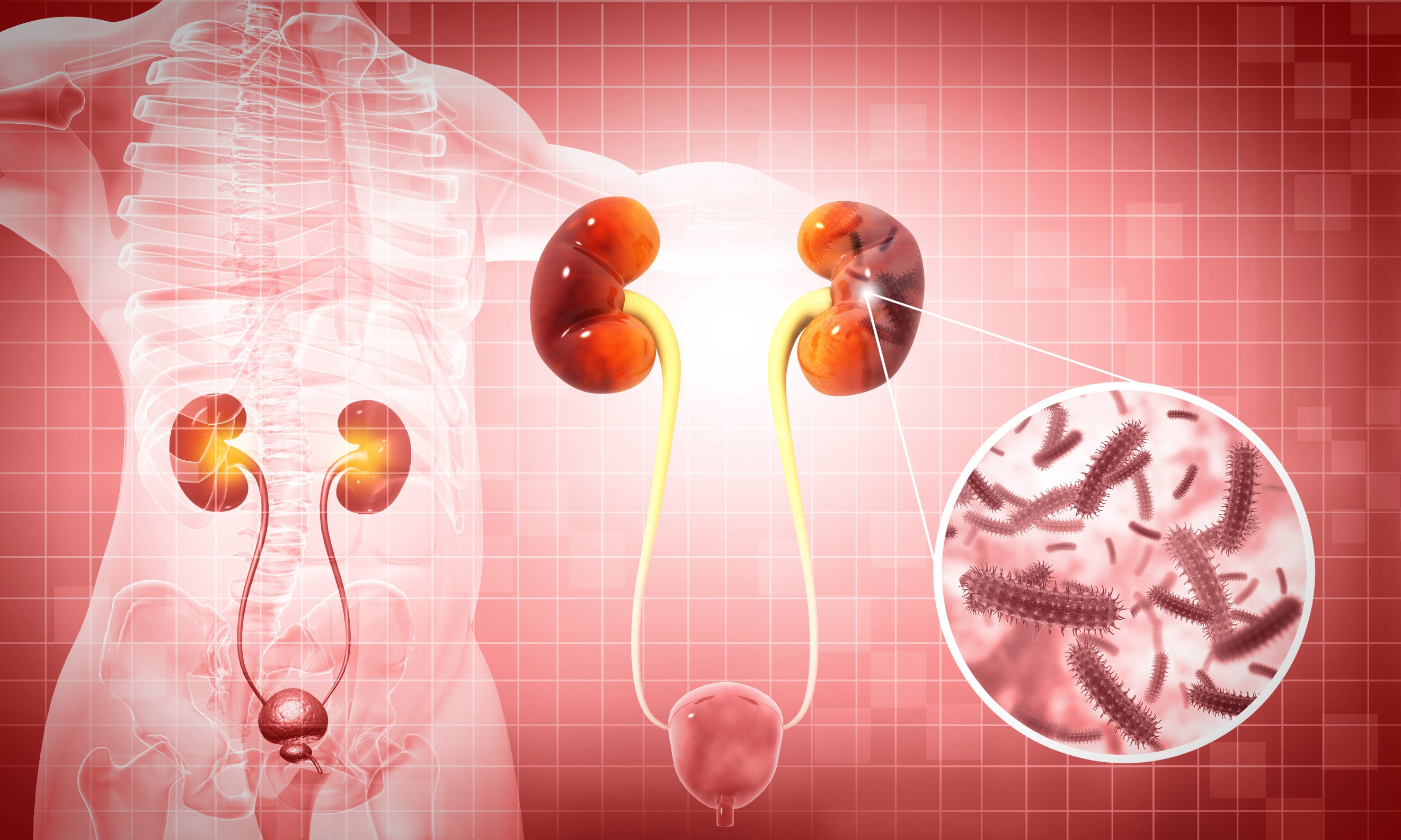 Emergency Endoscopic Urology Procedures