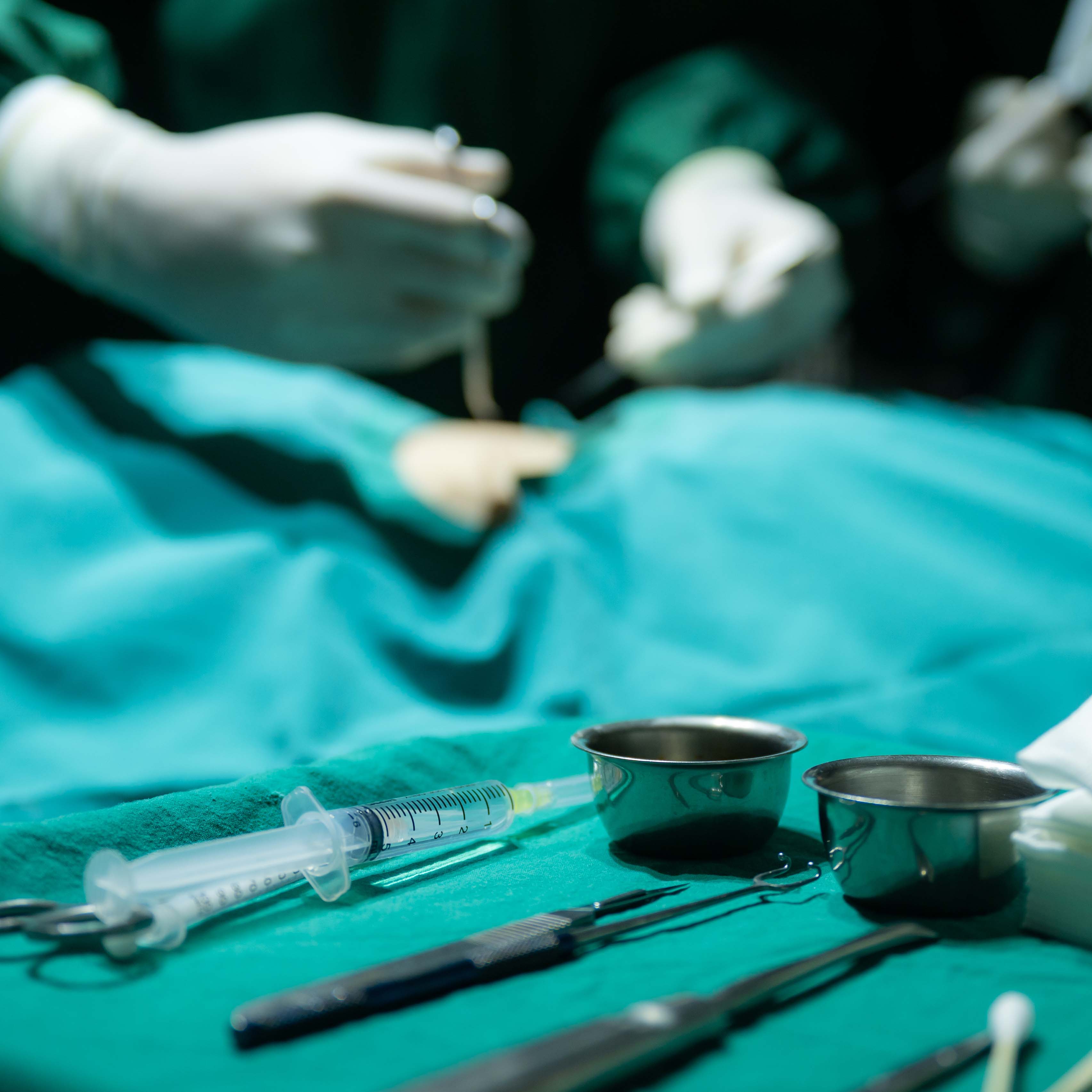 General Anaesthesia