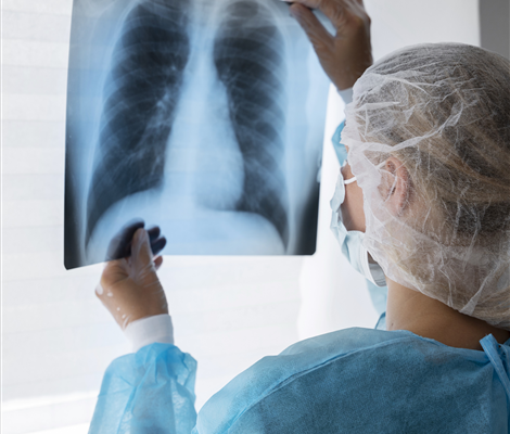 What is Tuberculosis (TB)?